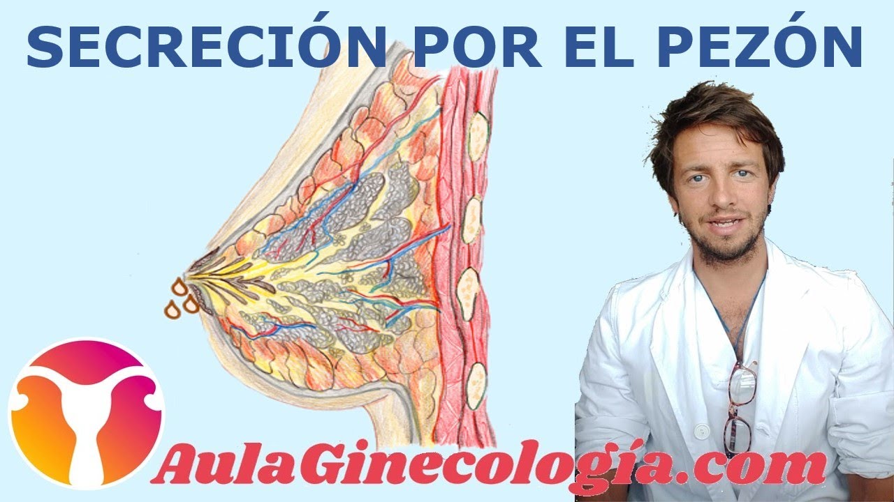 SECRECIÓN por el PEZÓN (PACIENTES): tipos, causas, diagnóstico... - Ginecología y Obstetricia