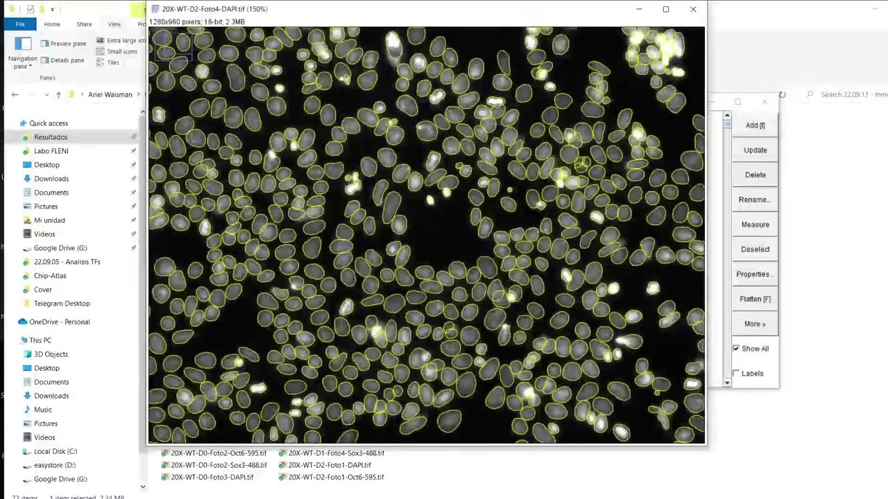 Analisis Automatico y Cuantitativo de Inmunofluorescencias - ImageJ y Macro - Parte1