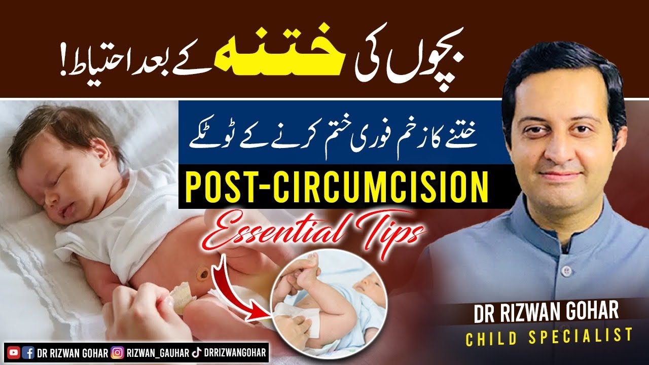 The Complete Guide to Post-Circumcision Care for Babies #Circumcision #care