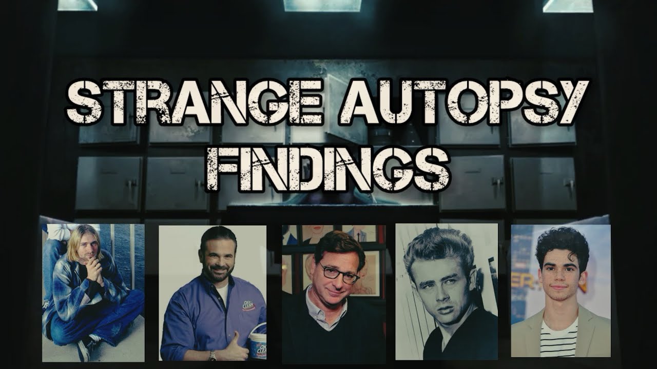 Celebrity Autopsies Shrouded in Mystery