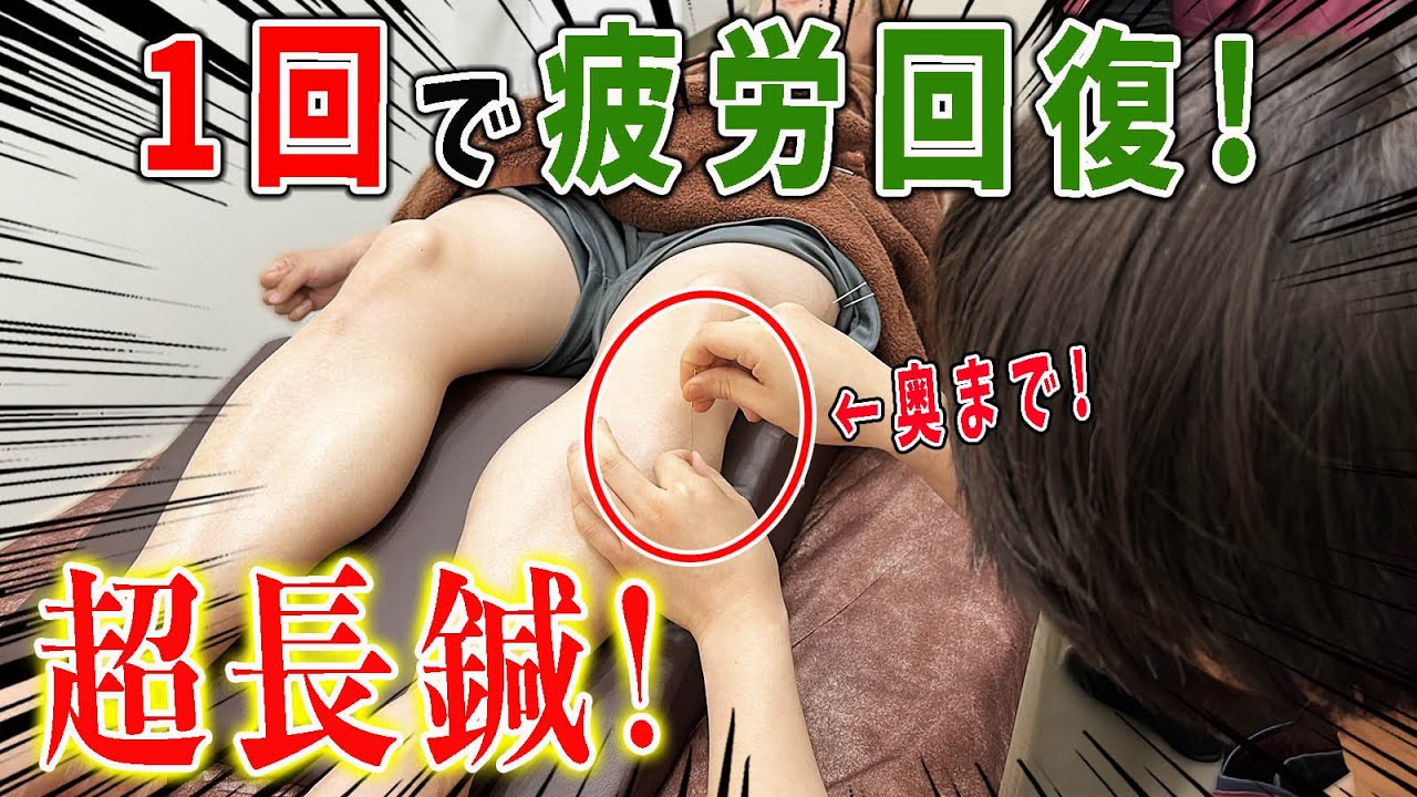 【鍼治療】たった1回の鍼治療で疲労を一気に回復！刺激的な美容鍼灸王子の鍼が凄すぎる！【@福岡美容鍼灸サロンCanna-カンナ- 】