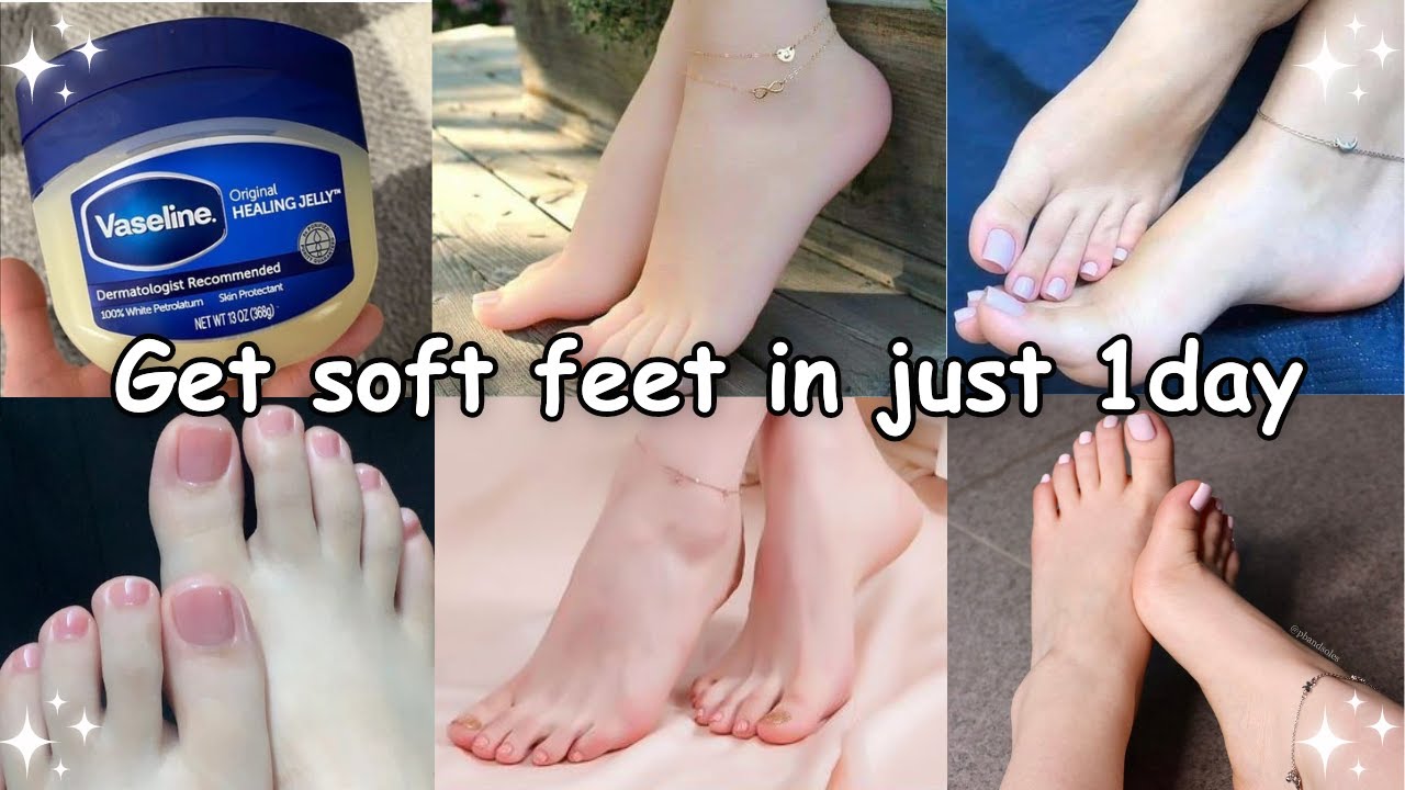 HOW I Got SOFT FEET in just 1 day  naturally