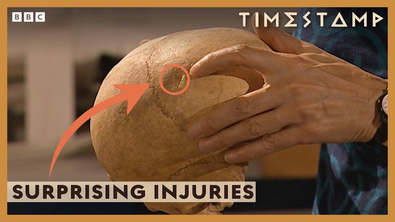 ‘Surprising’ Injuries Revealed On Skeleton of Medieval Priest | Meet the Ancestors | BBC Timestamp