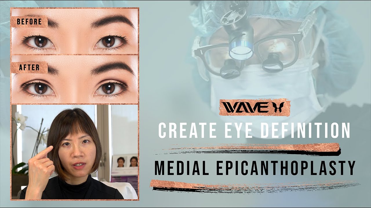 How To Make Your Eyes Look Bigger | Eye Enlargement  at Wave Plastic Surgery