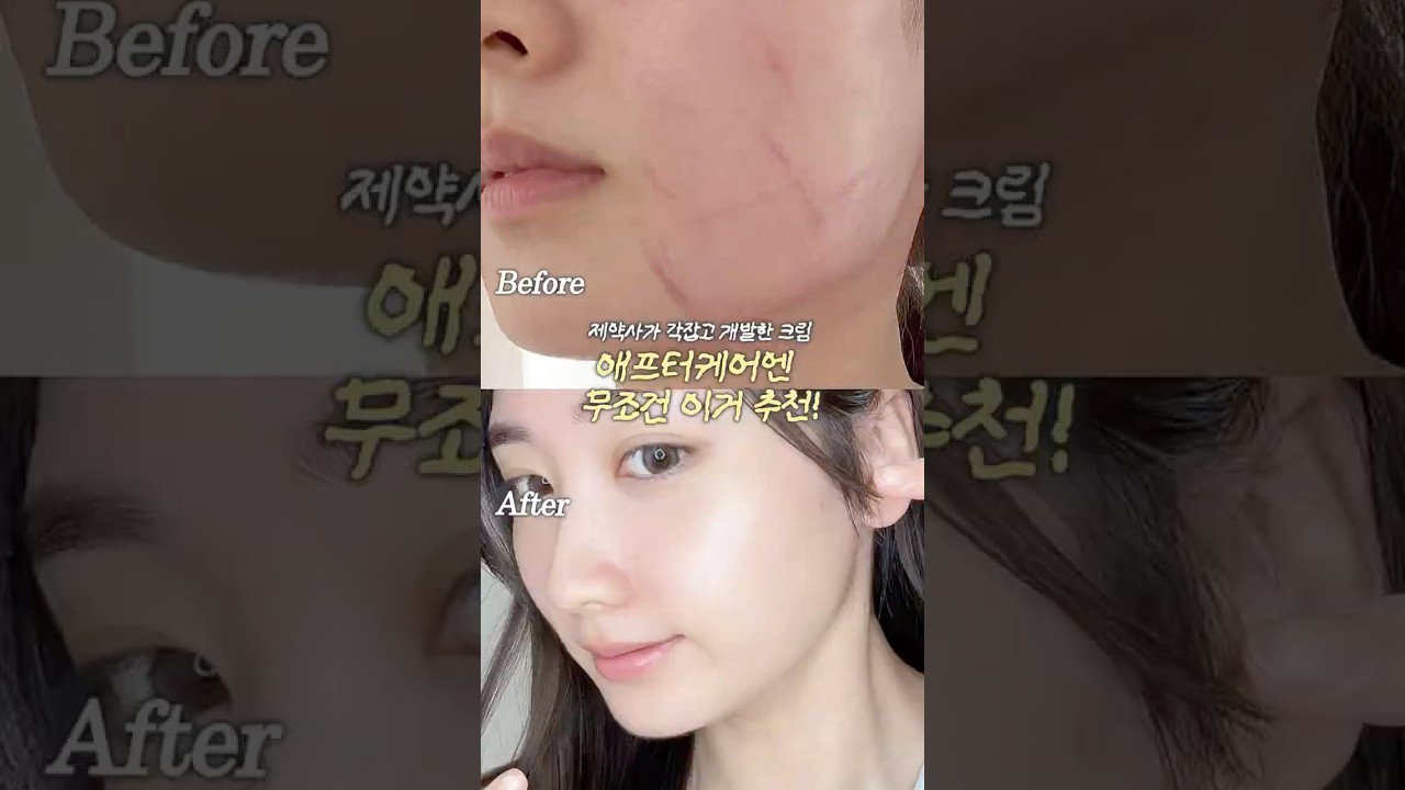 피부관리 후 무조건 쓰는 홈케어 올영관리템‼️ 애프터케어로 써주는 동국제약 센탈리안24 PDRN 마데카 크림✨