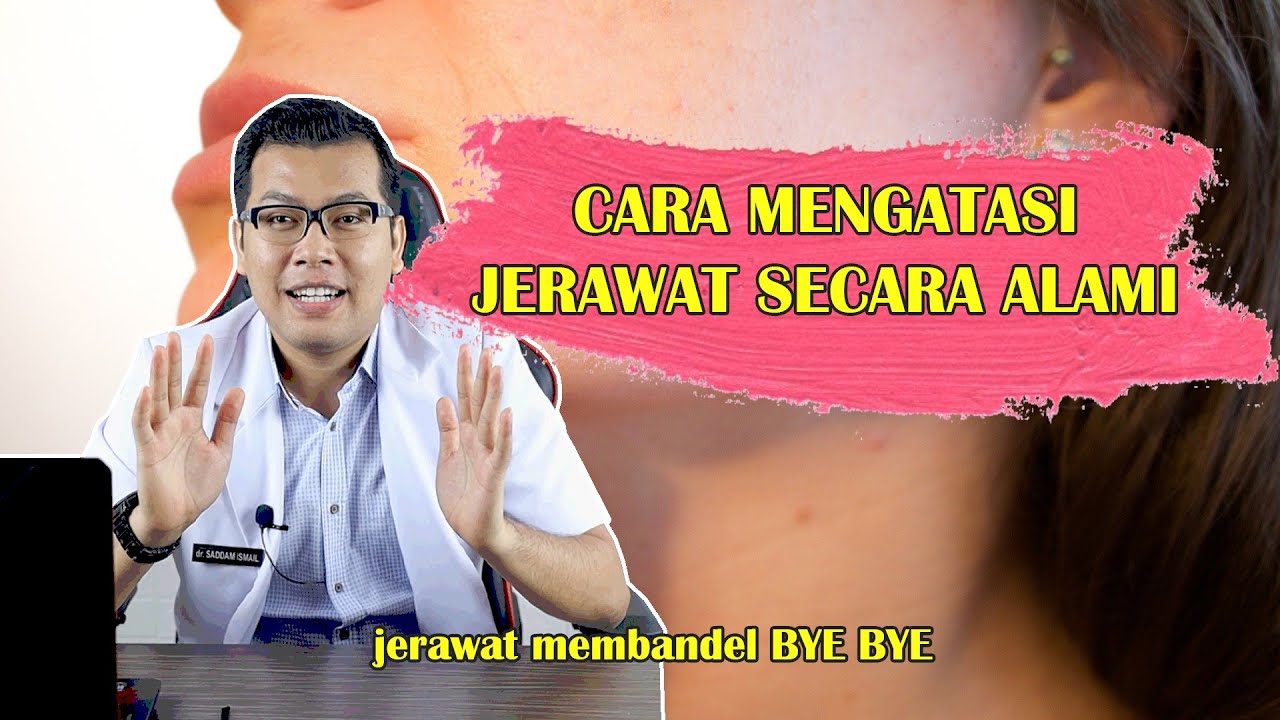 CARA MENGATASI JERAWAT SECARA ALAMI DAN AMAN UNTUK KULIT - DOKTER SADDAM ISMAIL