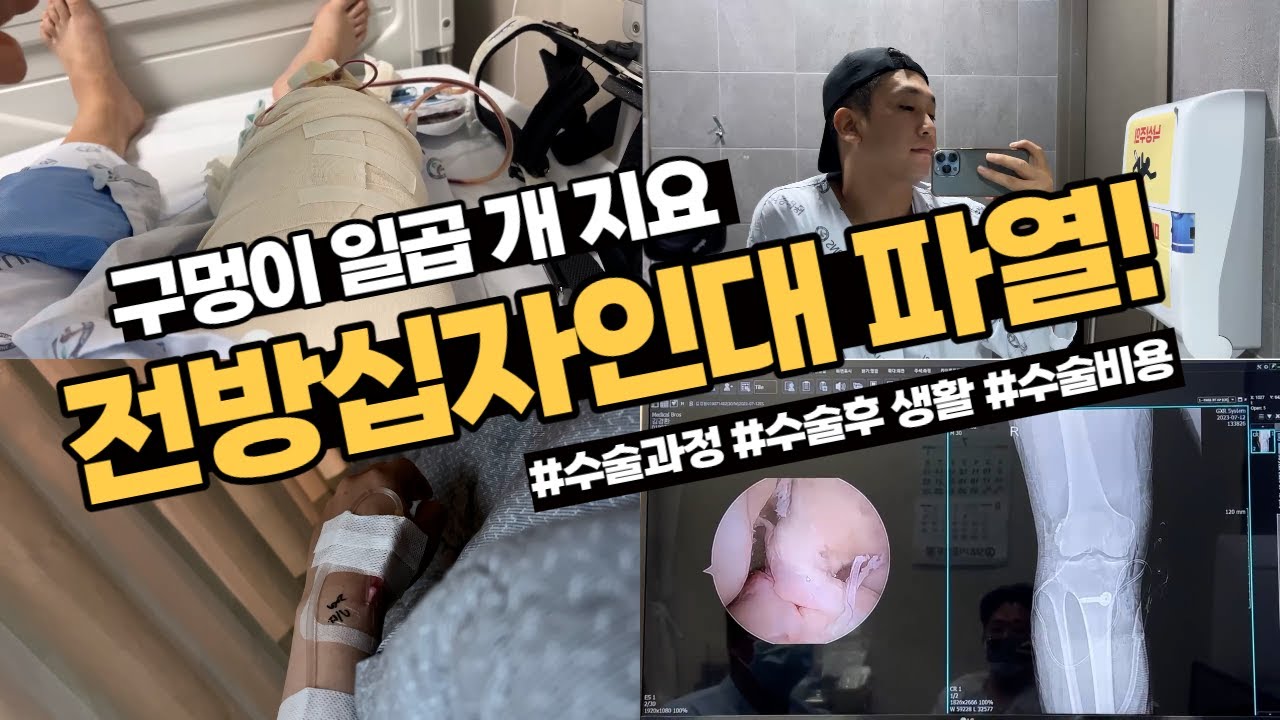 [입원 브이로그] 전방십자인대 수술, 다리수술, 무릎 수술, 재활치료, 수술비용, 수술과정 브이로그