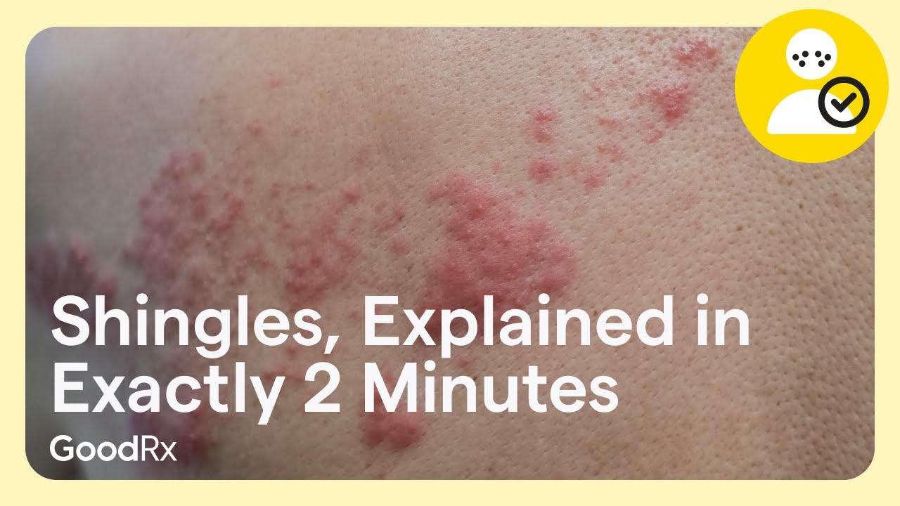 Shingles, Explained in Exactly 2 Minutes | GoodRx