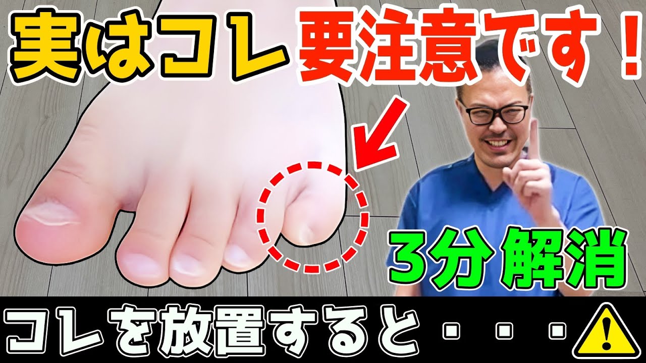 【これ放置してない？ 】 この寝指（内反小趾）3分で解消するだけで！(若返り｜お腹・足痩せ｜内臓脂肪・中性脂肪 減少｜頻尿・外反母趾・腰痛・膝痛・股関節痛 解消)