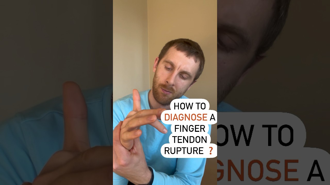 🚨Diagnose A Finger Tendon Rupture In 5 Seconds  #shorts