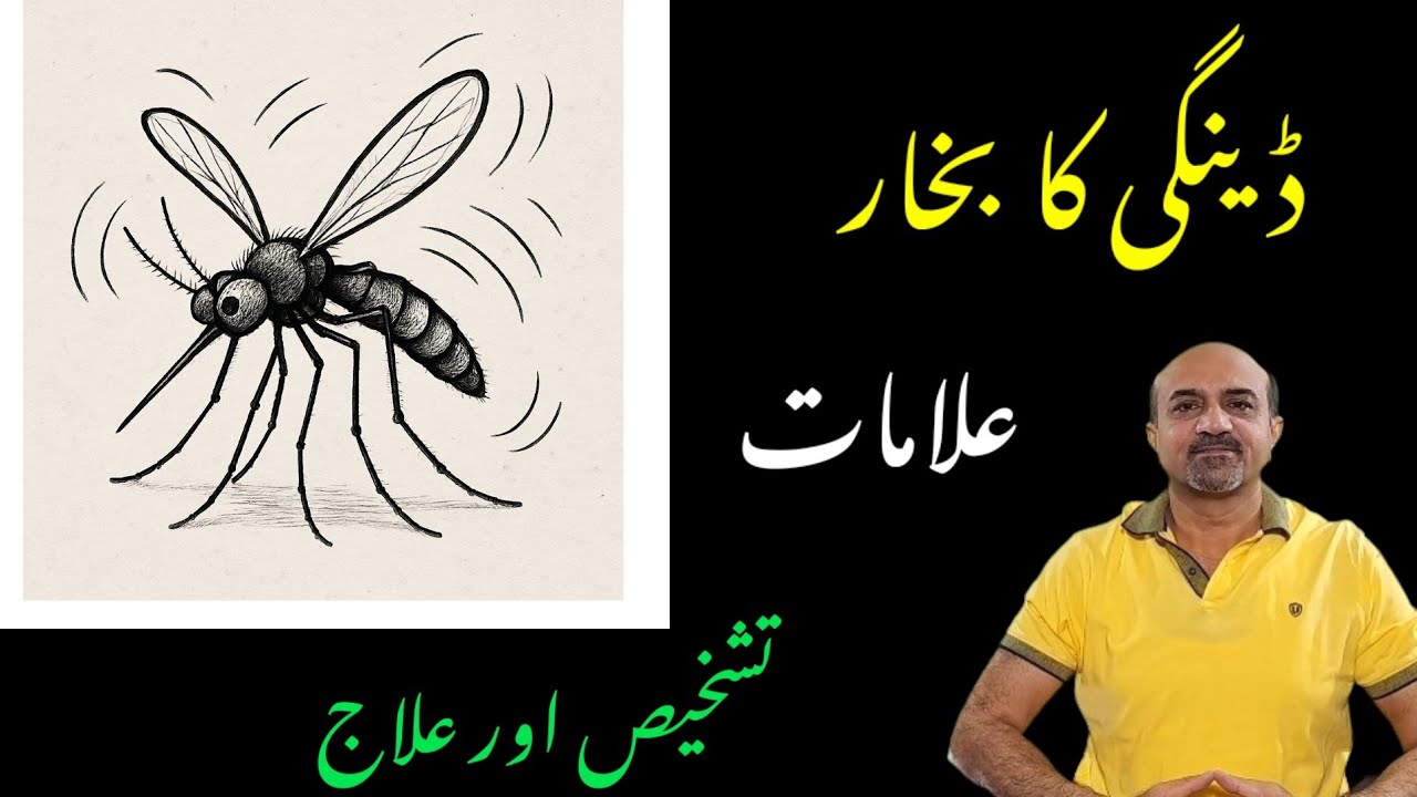 Dengue Fever: Diagnosis, Symptoms & Treatment Explained | Dr Afzal | Cardiology Official