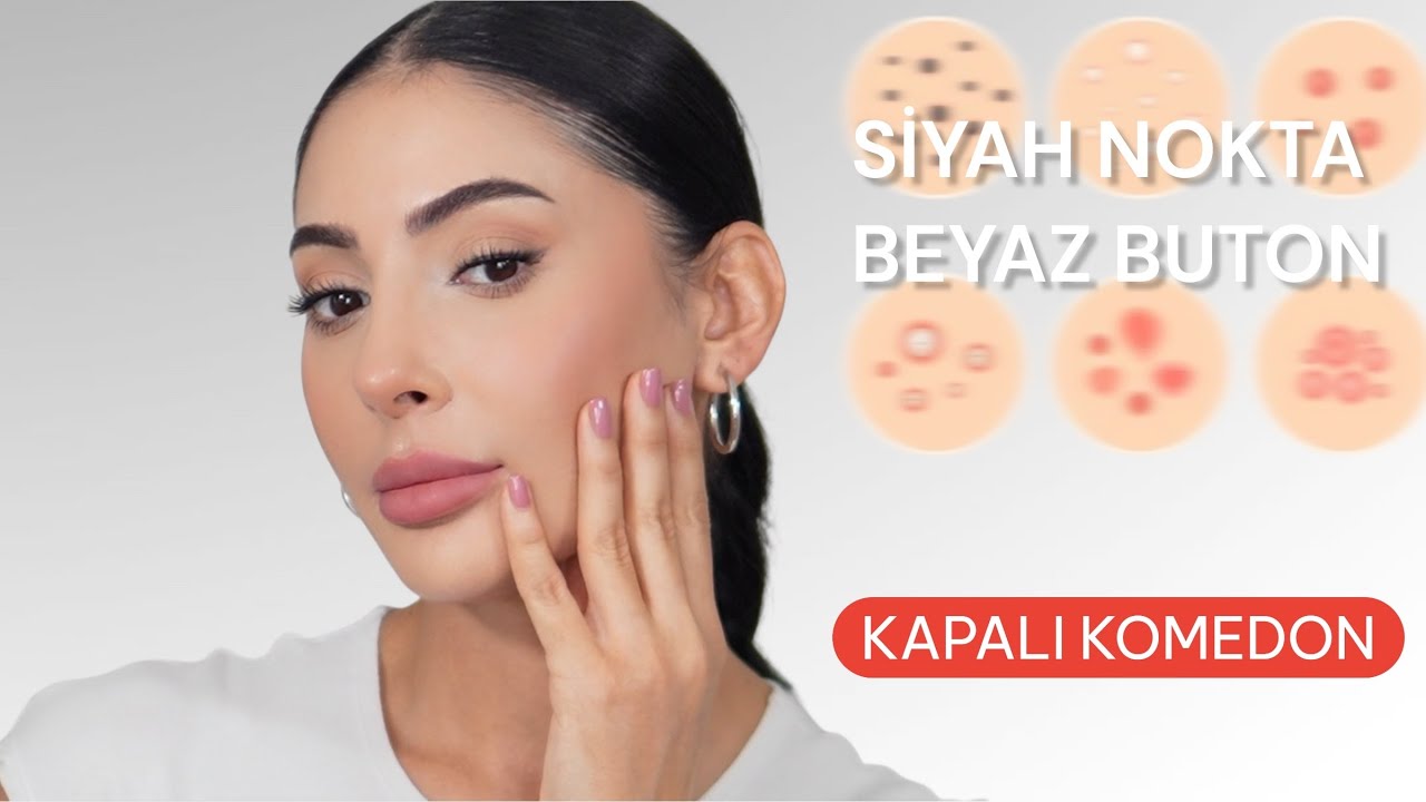 Yüzdeki Beyaz Buton ve Siyah Noktalarla Nasıl Mücadele Edilir?⚪️🔴