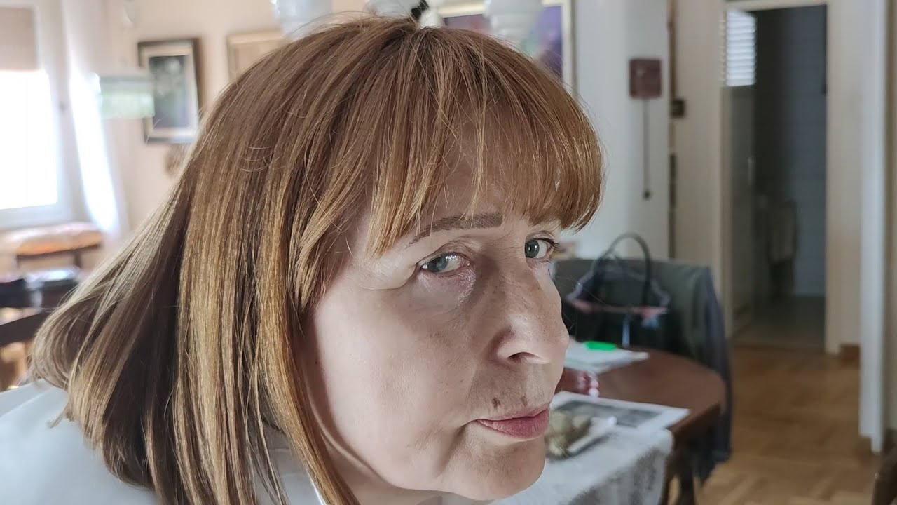 Blefaroplastika joj je život pretvorila u pakao