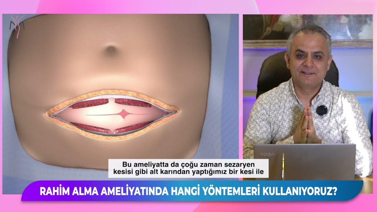 RAHİM ALMA AMELİYATINDA HANGİ YÖNTEMLERİ KULLANIYORUZ? #doğalyolcerrahisi #vnotes