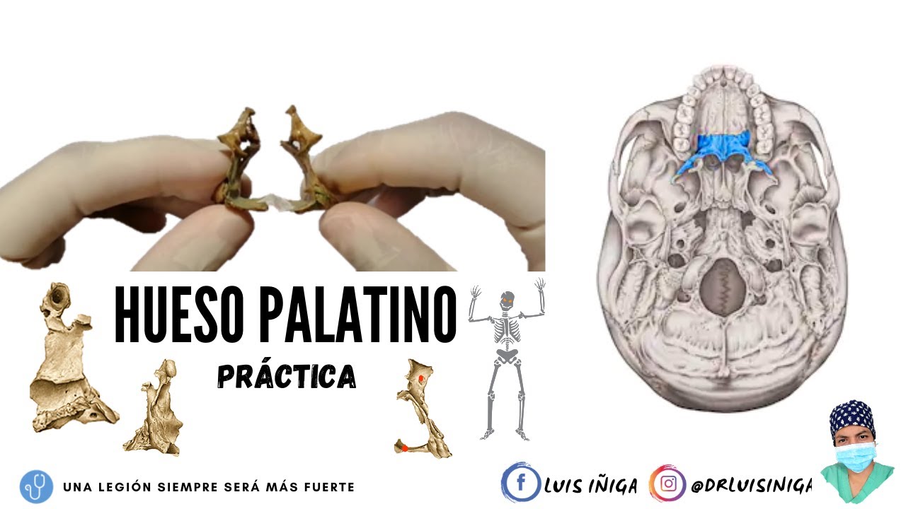 Anatomía: Hueso Palatino | Generalidades, porciones, caras, bordes, accidentes | Práctica