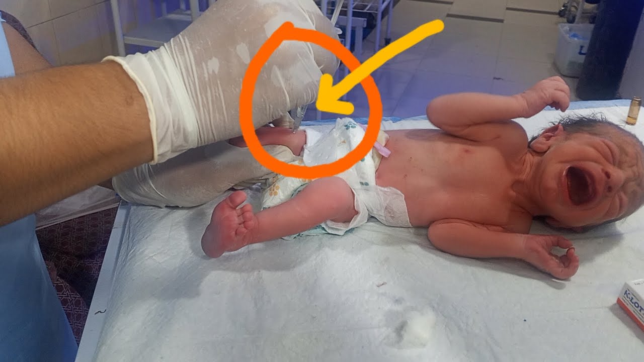Just Born Baby 💕 | Adorable First Moves & Vitamin K Shot in NICU | Warmer Care 🩺🍼🩺#baby #nicubaby 