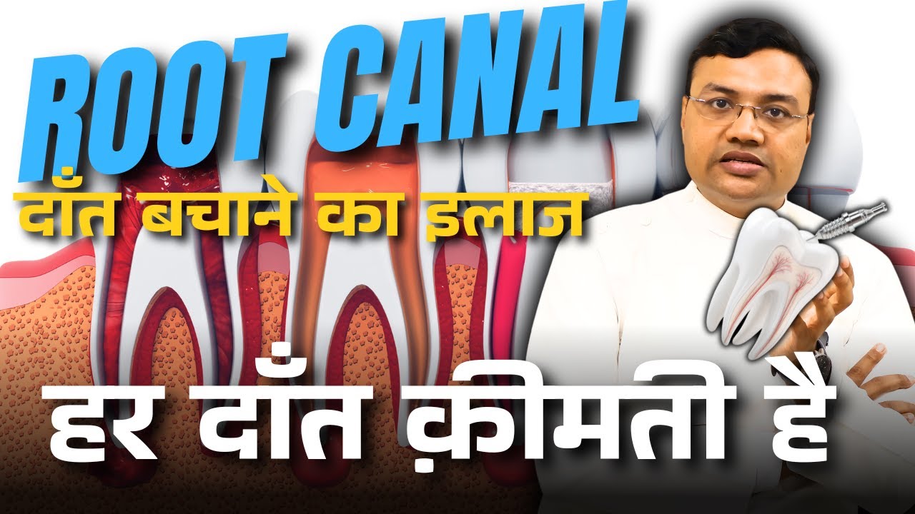 Save Your Natural Tooth | Root Canal Treatment Explained by Dr. Kapil Gupta