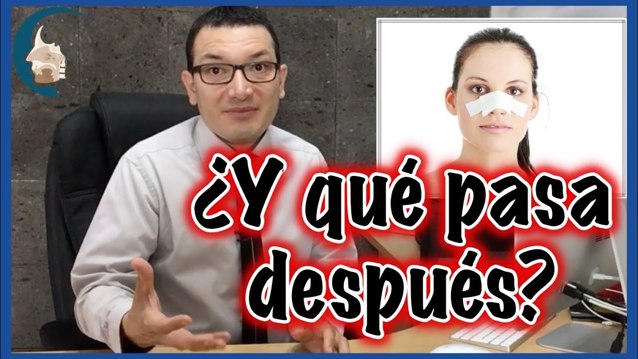 CUIDADOS después de una  RINOPLASTÍA 😰👃🏻🤕 - PlasticFacial MX