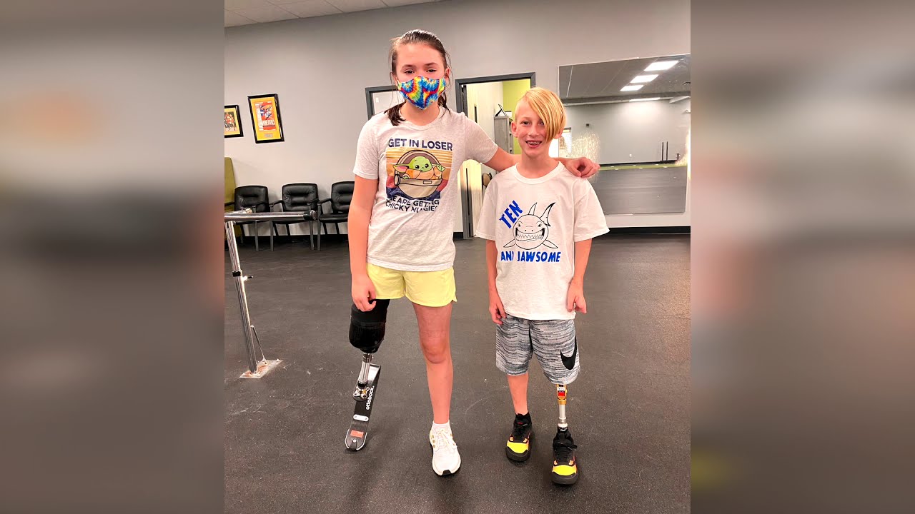 Kate, Knee Disarticulate PPS & Trip AK - New Prosthetic Sockets
