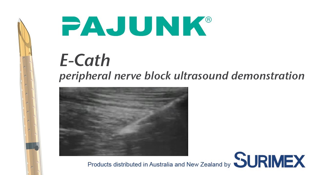Surimex: Pajunk E-Catheter Kit acc. Tsui (ultrasound continuous peripheral nerve block 2)