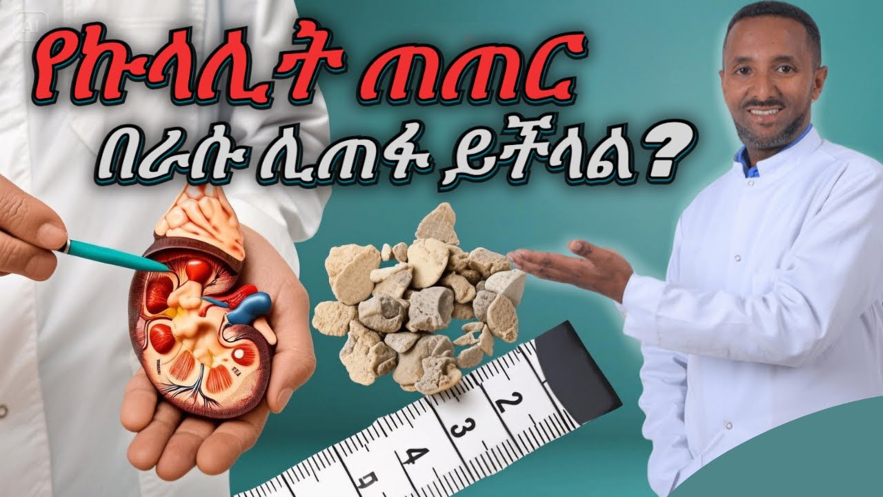 የኩላሊት ጠጠር፡ በራሱ ሊጠፋ ይችላል | Kidney stones: Can they disappear on their own? | Dr. Azmeraw | ዶ/ር አዝመራው