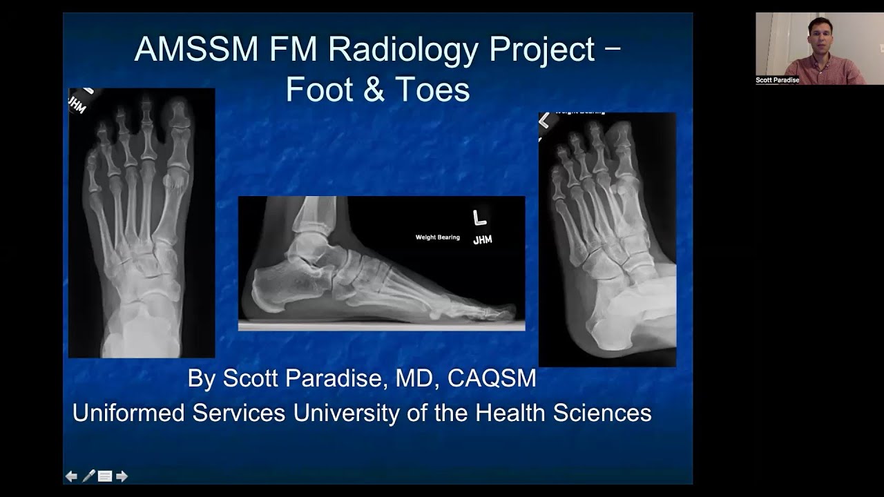 Foot and Toes | MSK Radiology: X-Ray Educational Modules for Primary Care Residents