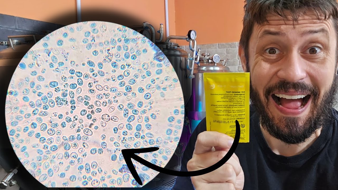Levedura Vencida Ainda Funciona? Analisei No Microscópio e Me Surpreendi!