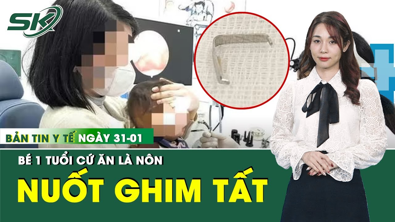 Bản Tin Y Tế 31/1: Phát hiện chiếc ghim tất trong vòm họng khiến bé 1 tuổi cứ ăn là nôn | SKĐS