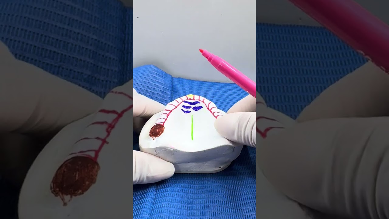 Anatomía de la arcada superior del desdentado 