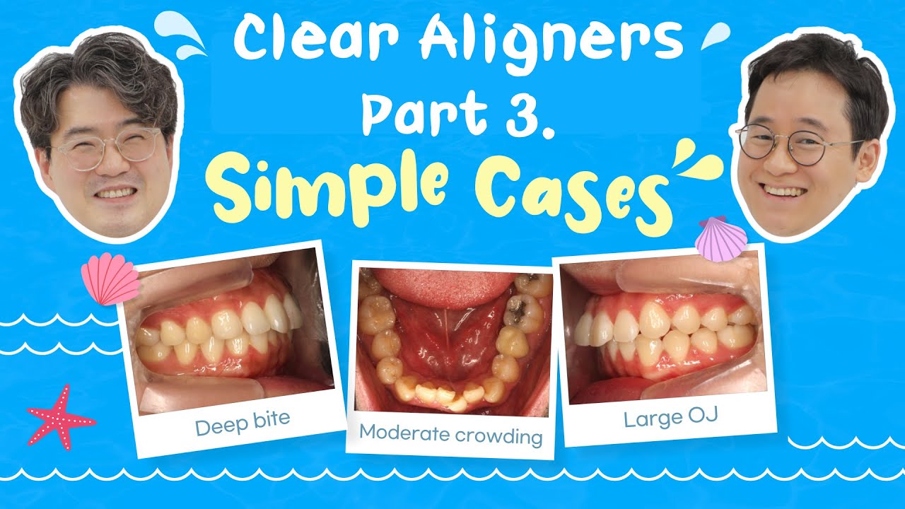 [Ortho Barista] Clear Aligners Part 3. Simple cases for dental practices (AI Voice-Over)