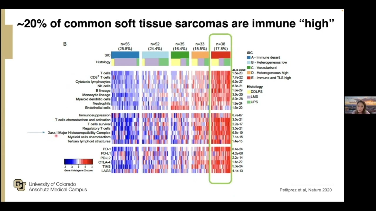 The Role of Immunotherapy in the Management of Sarcomas