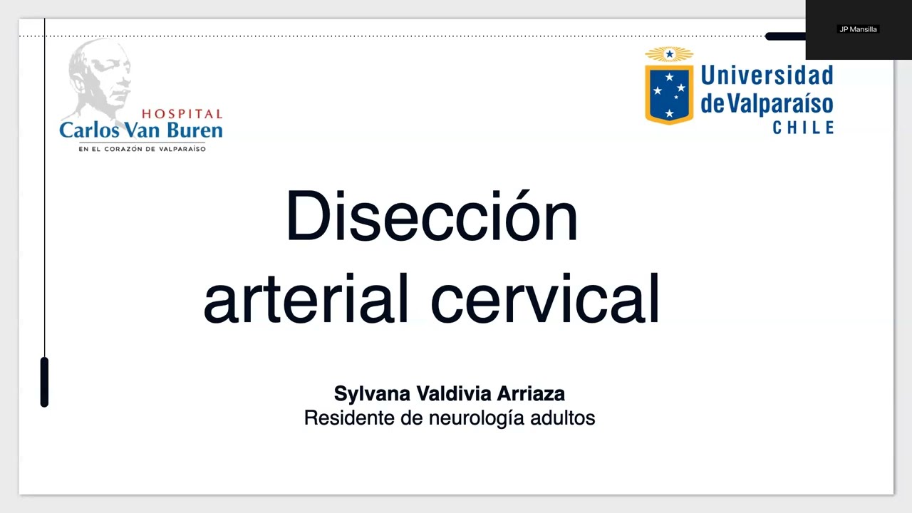 Disección Arterial Cervical