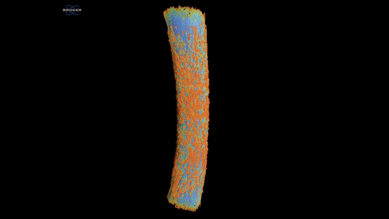 A fetal chick femur, microCT - 1.3um voxel. Bone-modelling cells visible on surface. SkyScan 1272