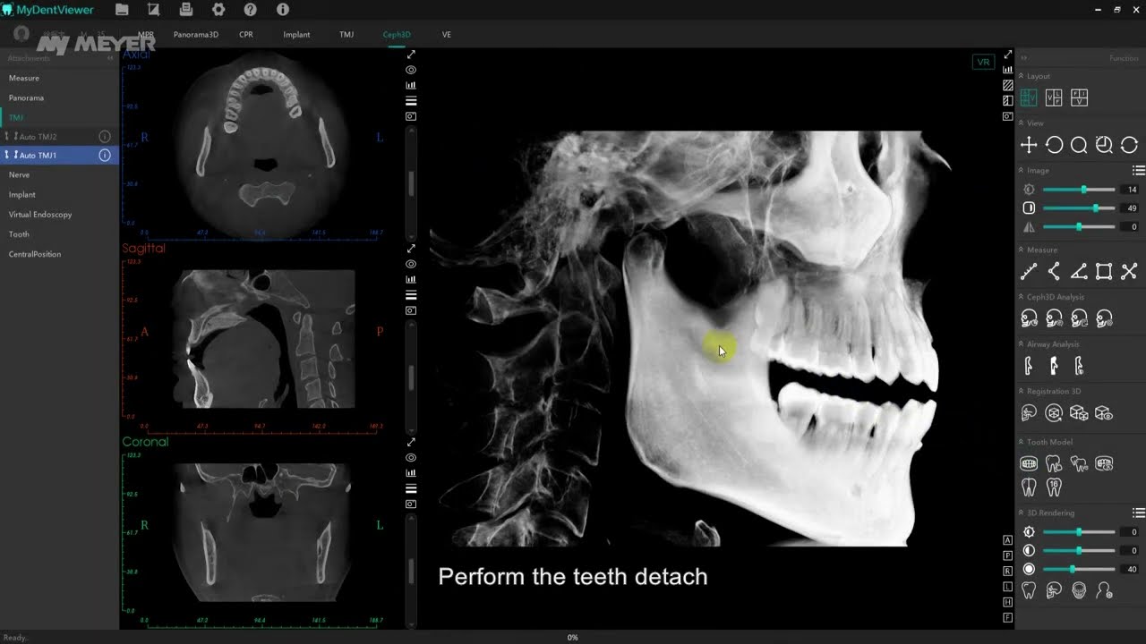 MyDent Viewer - 3D Orthodontics
