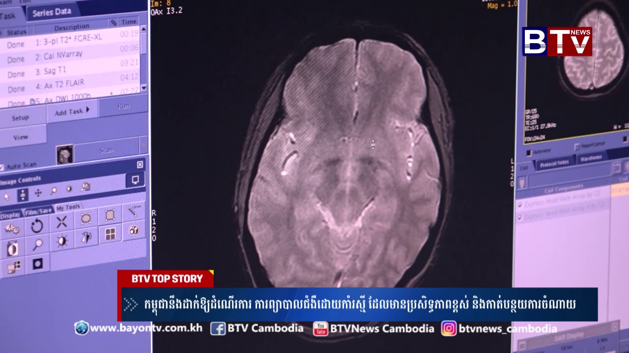 កម្ពុជា​នឹង​ដាក់​ឲ្យ​ដំណើរ​កា​រ​ ការព្យាបាល​ជំងឺ​ដោយ​កាំរស្មី ដែល​មាន​ប្រសិទ្ធ​ភាព​ខ្ពស់  និង​កាត់​ប