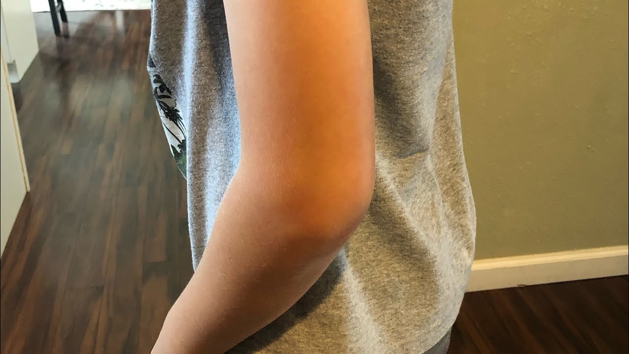 Is it broken?