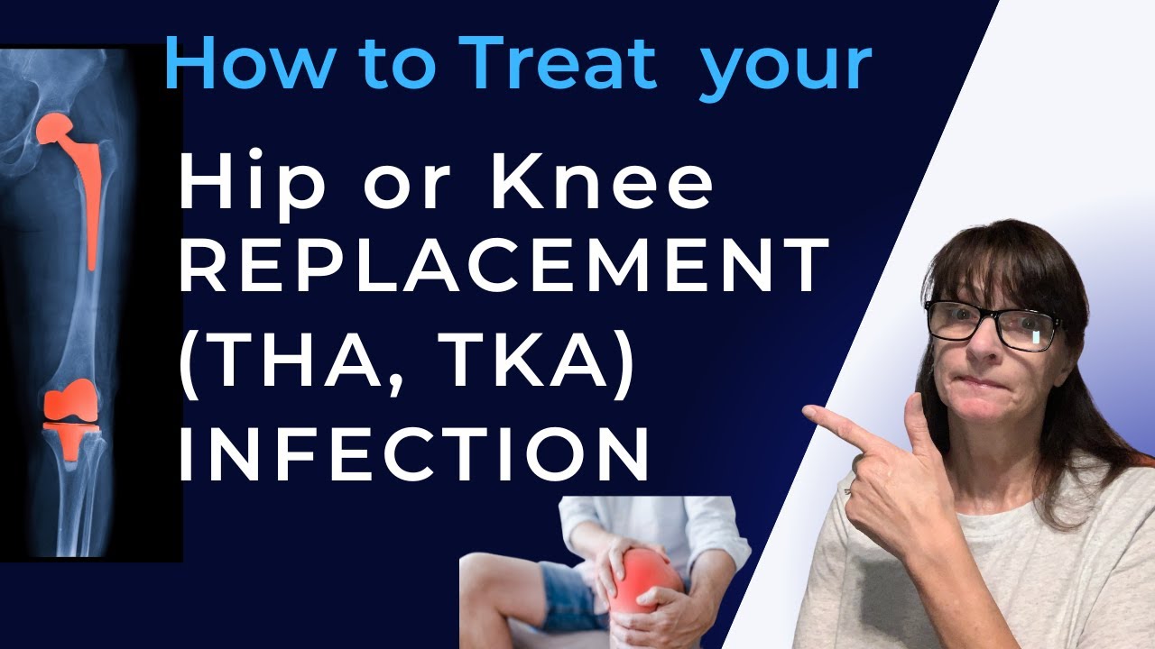 How to Treat Your Hip or Knee Replacement (THA, TKA) Infection