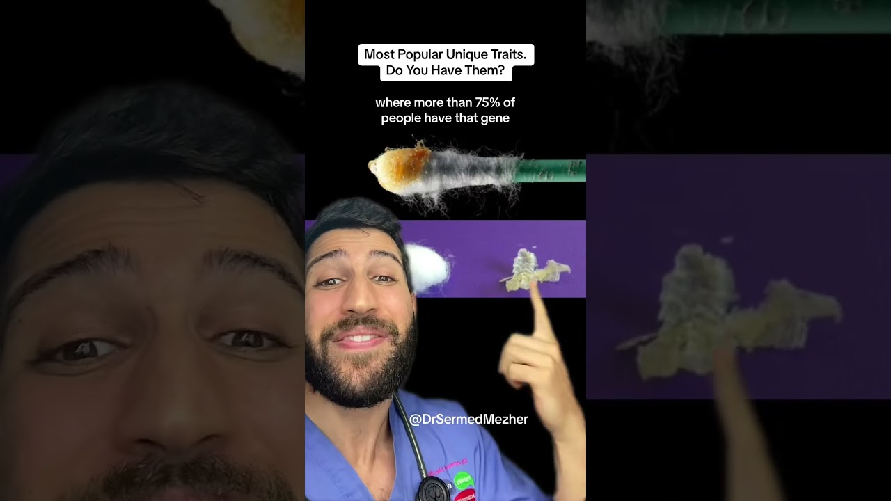 Most Popular Unique Traits, Do You Have Them? #features