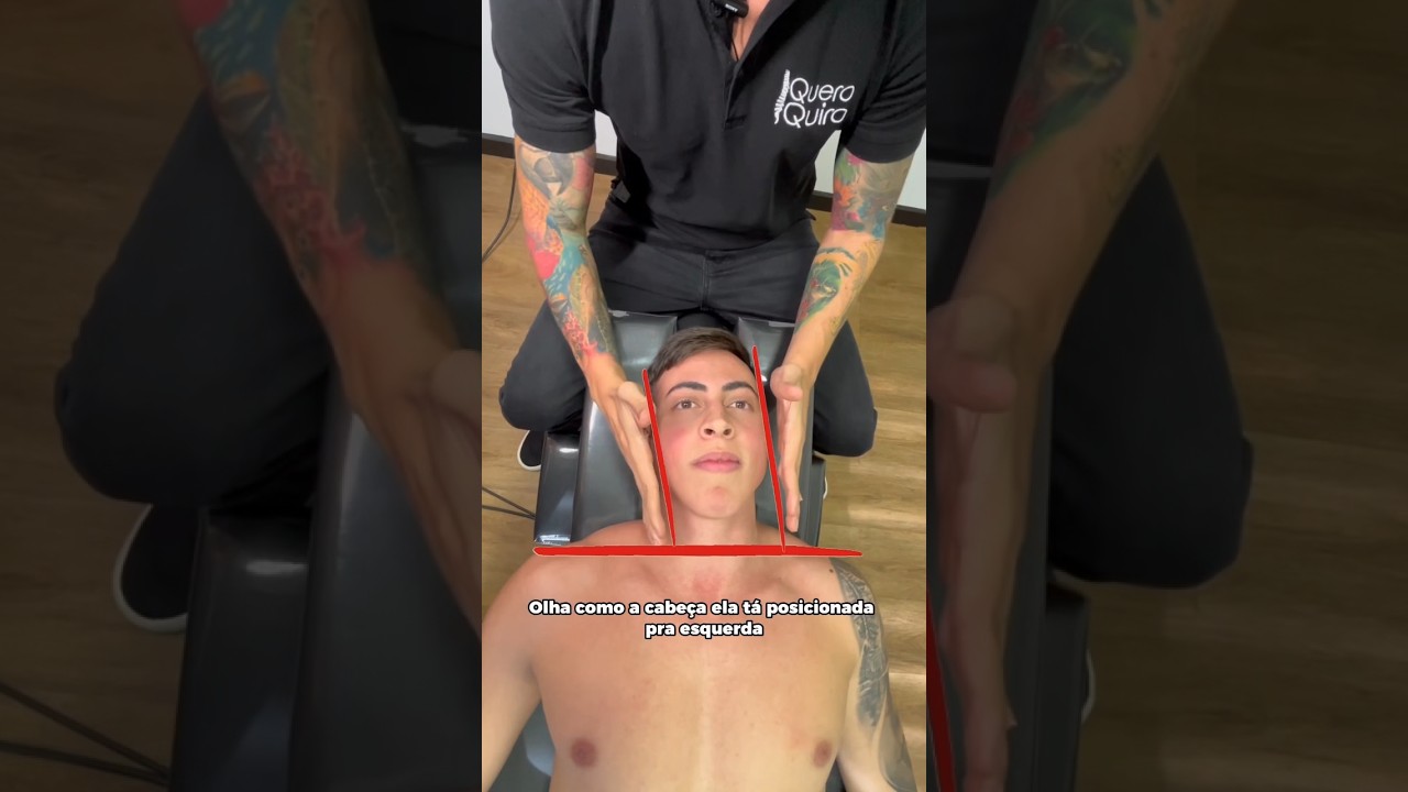CABEÇA DESALINHADA?? Veja antes e depois da quiropraxia