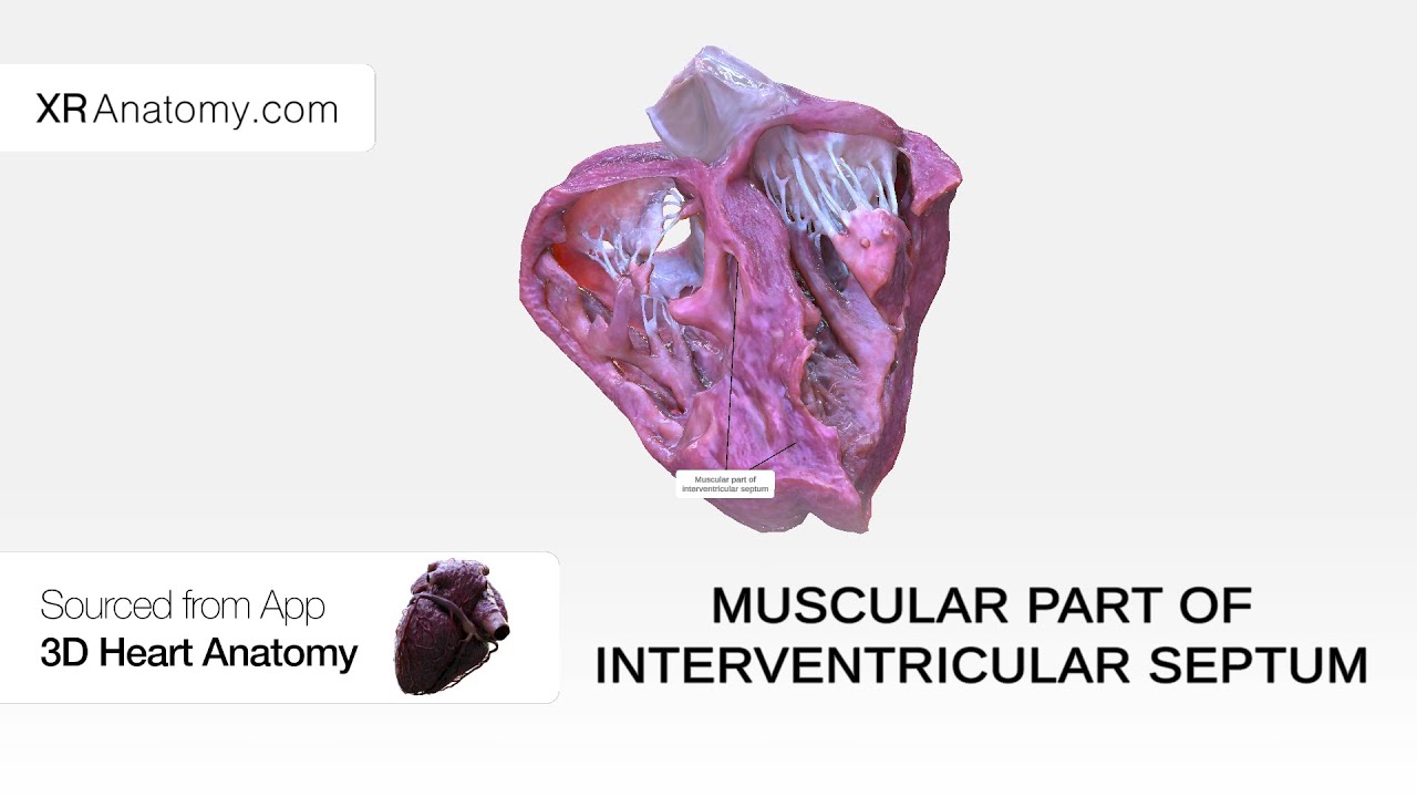 Muscular part of interventricular septum