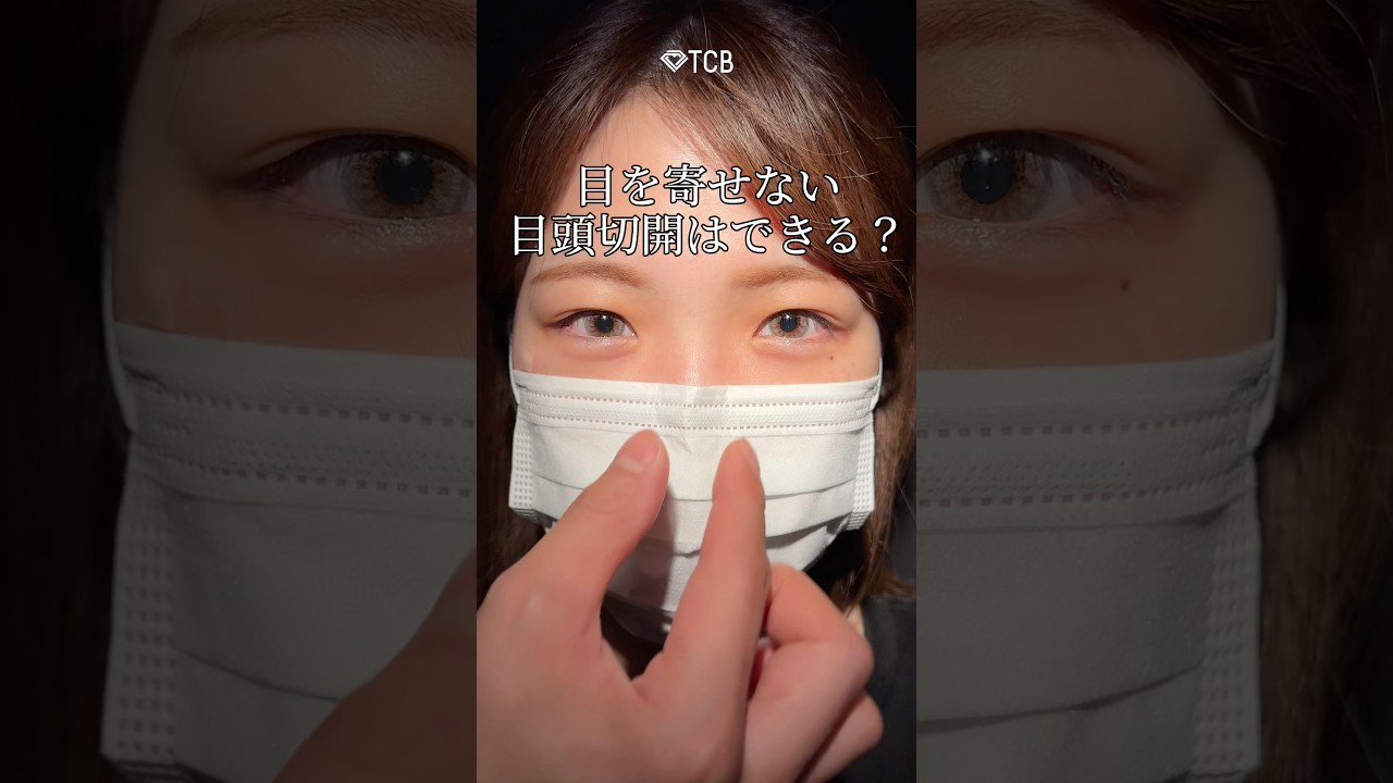 【二重整形】目を寄せない目頭切開？ #shorts