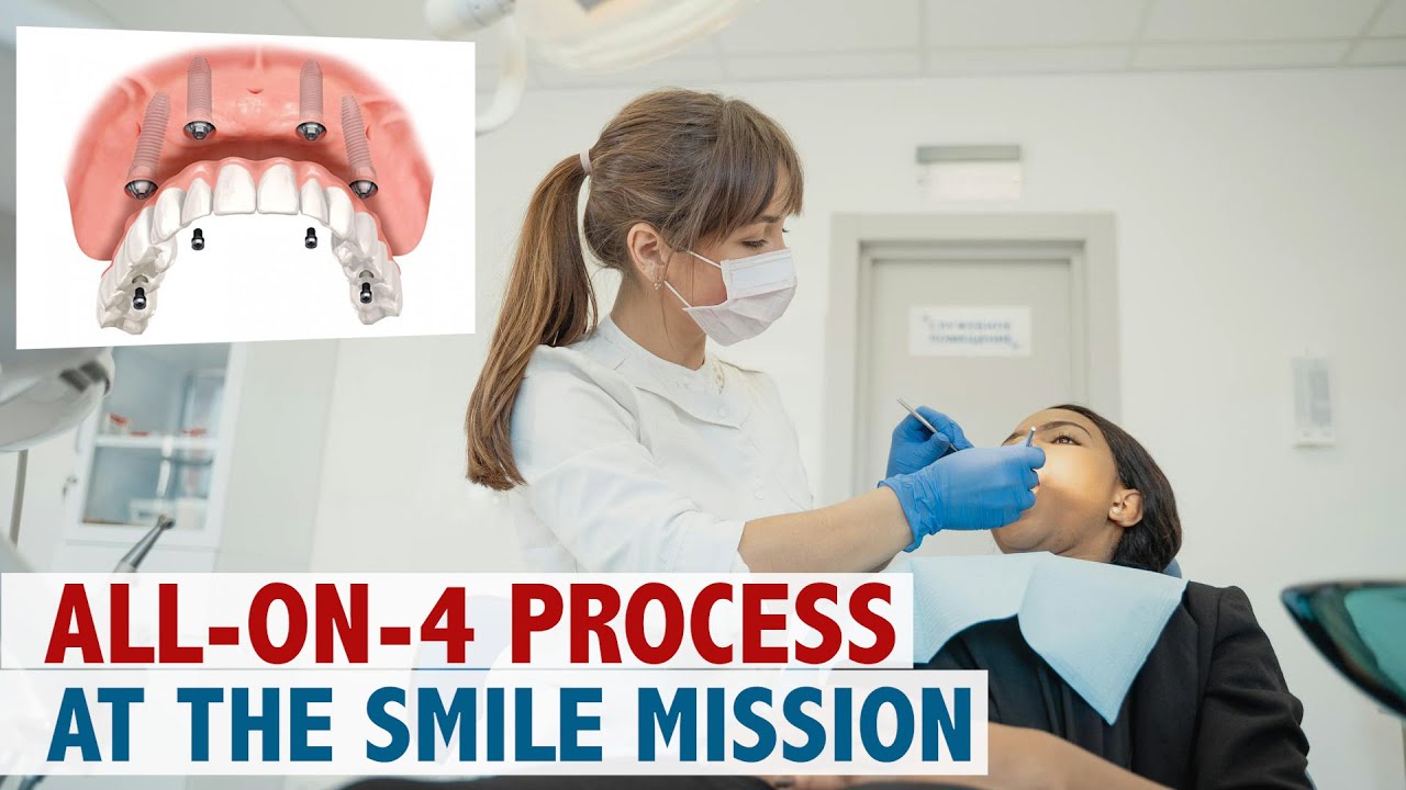 All-On-4 Process at The Smile Mission