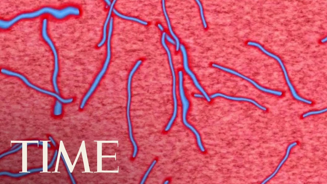 Three People In Uganda Died From The Marburg Virus: How It's Similar To Ebola Virus | TIME