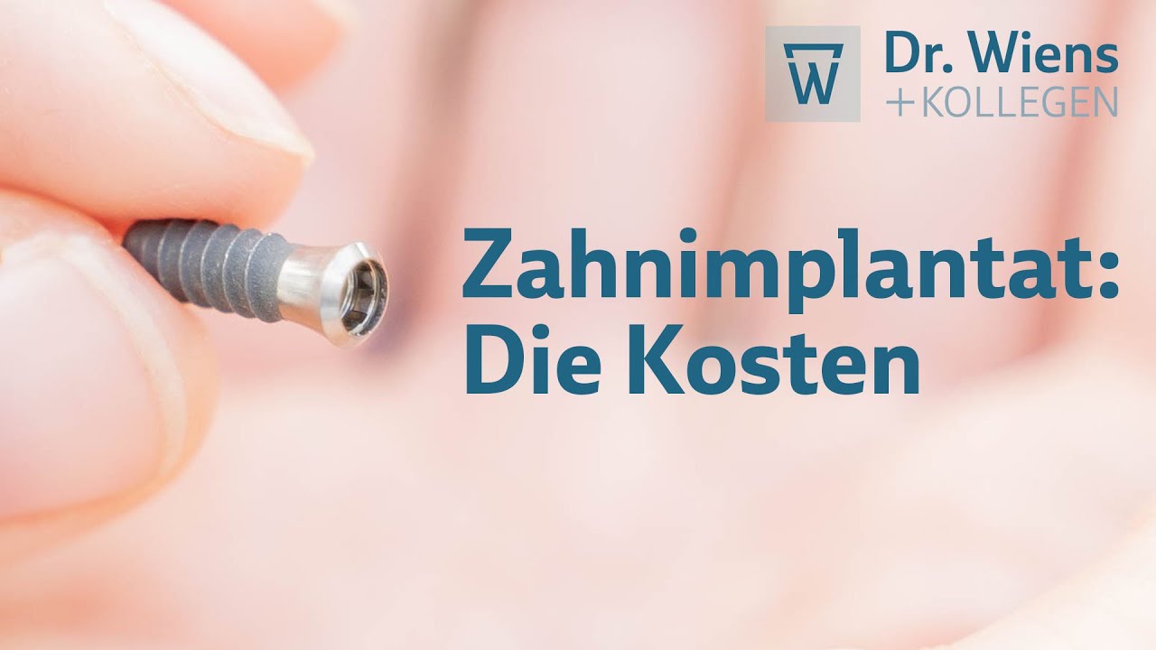 Zahnimplantat: die Kosten