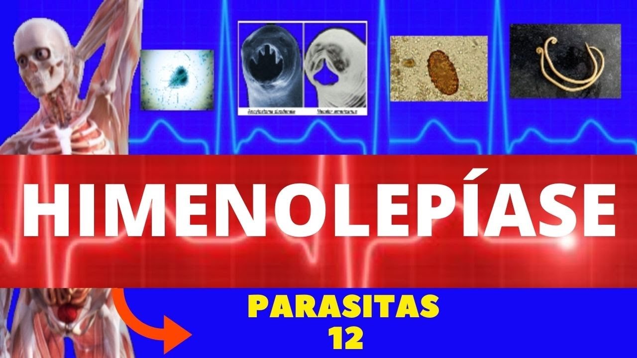 HIMENOLEPÍASE - HYMENOLEPIS NANA E HYMENOLEPIS DIMINUTA (TÊNIA ANÃ) - PARASITOLOGIA| INFECTOLOGIA