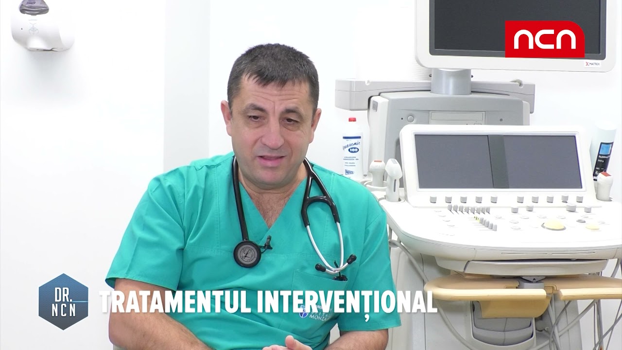 Marius Andronache, medic cardiolog - Fibrilatia atriala si tratamentul prin ablatie