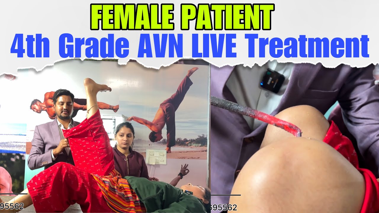 FEMALE PATIENT: 4th Grade AVN Live Treatment ✅ | Sushrut Ayurveda Darshan Hospital 🏥 Dehradun