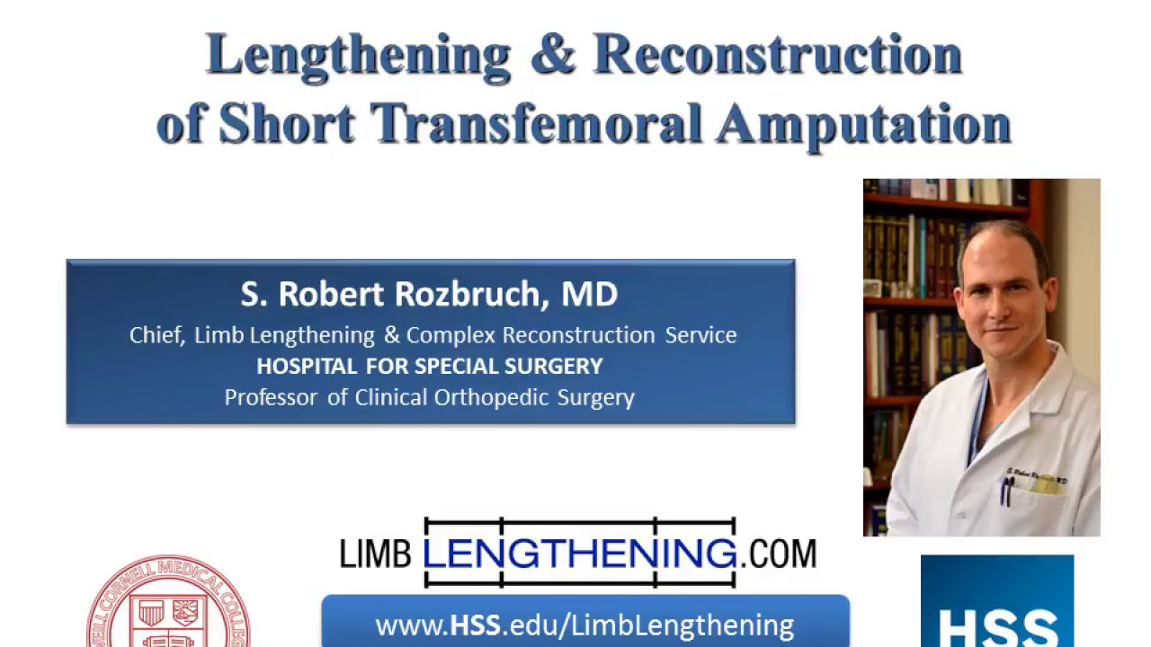 Lengthening and Reconstruction of Short Transfemoral Amputation