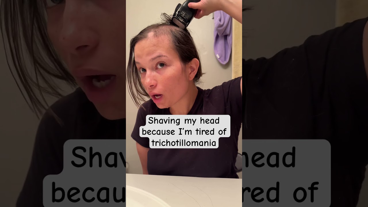 #trichotillomania #hairpulling #hairloss #bald #anxiety #ocd #mentalhealthawareness #mentalhealth