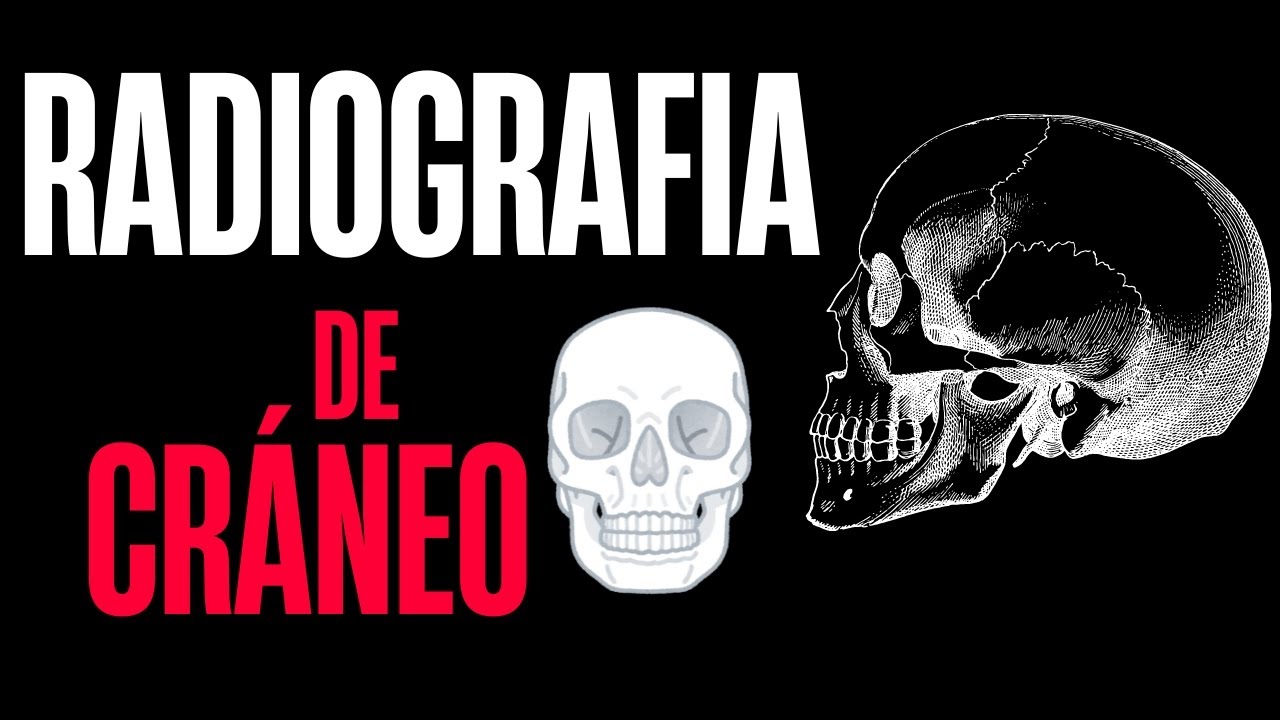 Anatomía radiológica del cráneo | Proyecciones ANTEROPOSTERIOR, LATERAL y WATERS